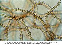 Arcyria denudata image