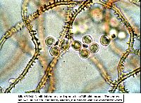 Arcyria denudata image