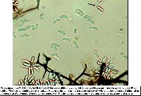 Neta patuxentica image