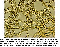 Arcyria pomiformis image