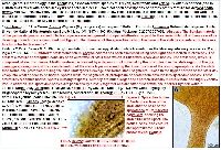 Arcyria pomiformis image