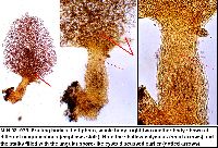 Arcyria pomiformis image