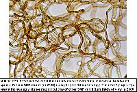 Arcyria pomiformis image
