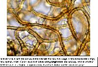 Arcyria pomiformis image