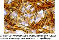 Arcyria pomiformis image