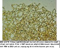 Arcyria pomiformis image