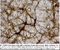 Stemonitis fusca image