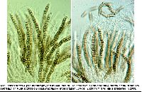 Lophiostoma quadrinucleatum var. triseptatum image