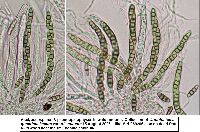 Lophiostoma quadrinucleatum var. triseptatum image