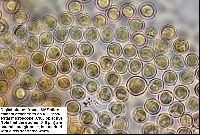 Arcyria denudata image