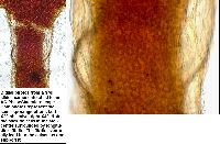 Arcyria denudata image