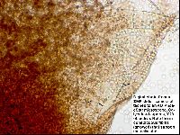 Arcyria denudata image