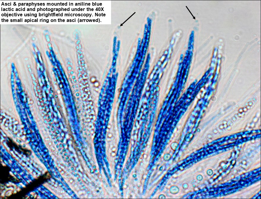 Chaetosphaeriaceae image