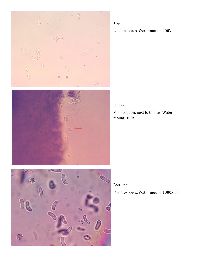 Exidia crenata image