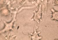 Asterophora lycoperdoides image