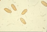 Boletus luridus image