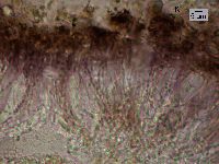 Media resource of Lambiella caeca