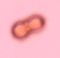 Carum carvi image