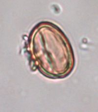 Hypericum boreale image