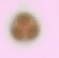 Viburnum opulus var. americanum image