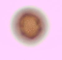 Viburnum opulus var. americanum image