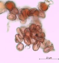Media resource of Hypericum ellipticum