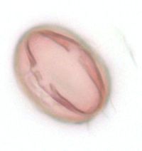 Amelanchier bartramiana image
