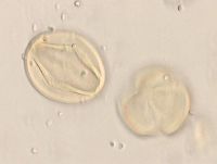 Aronia melanocarpa image