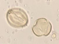 Media resource of Aronia melanocarpa