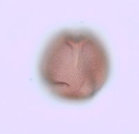 Rhus typhina image