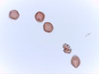 Rhus typhina image