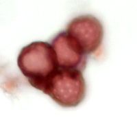 Dysphania botrys image