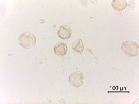 Staphylea trifolia image