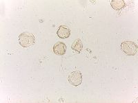 Media resource of Staphylea trifolia