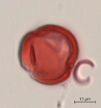 Aronia melanocarpa image