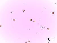 Amaranthus tuberculatus image