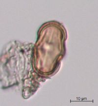 Image Associated With the Occurrence