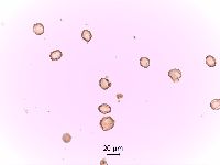 Hypericum punctatum image