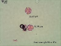 Anemone cylindrica image